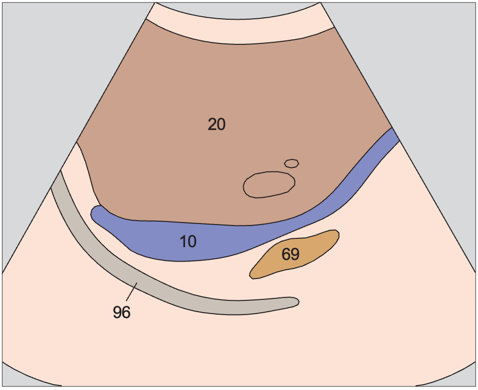 Adrenal gland, vena cava, renal artery