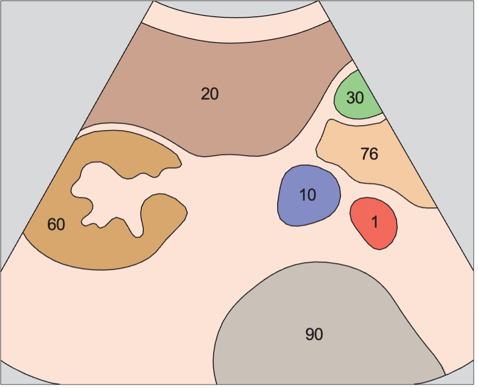 Kidney, vena cava