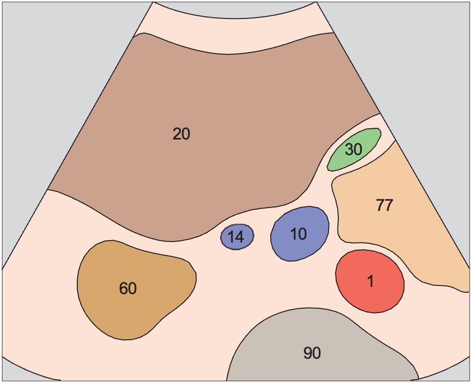Kidney, renal vein, vena cava