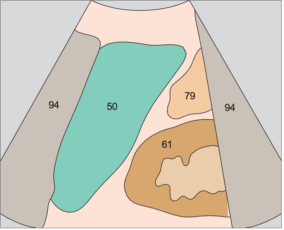 Kidney, spleen