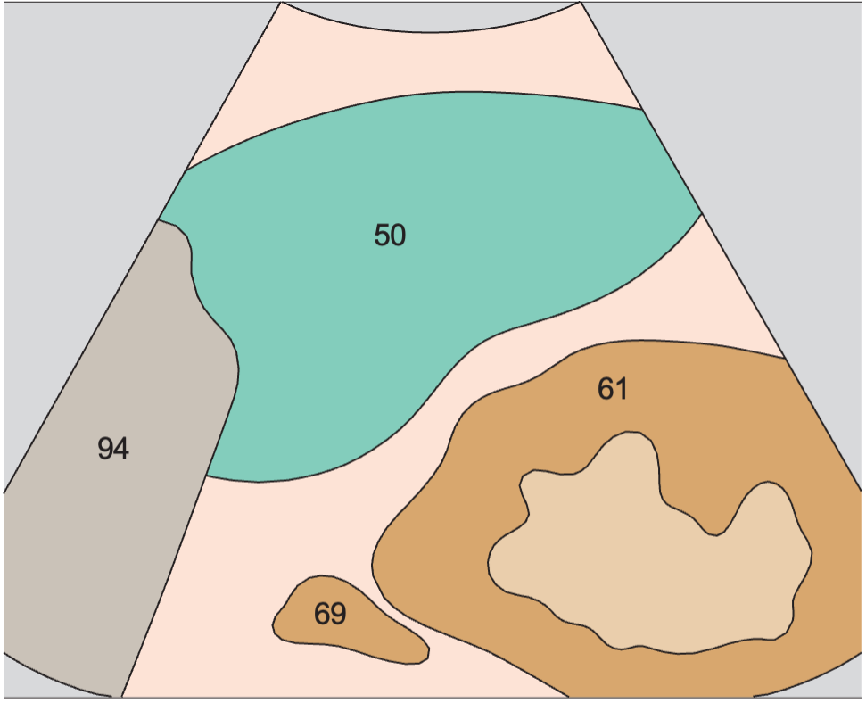 Adrenal gland, kidney, spleen