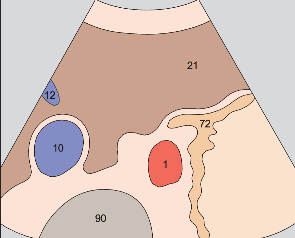Cardia, body of stomach, aorta, liver