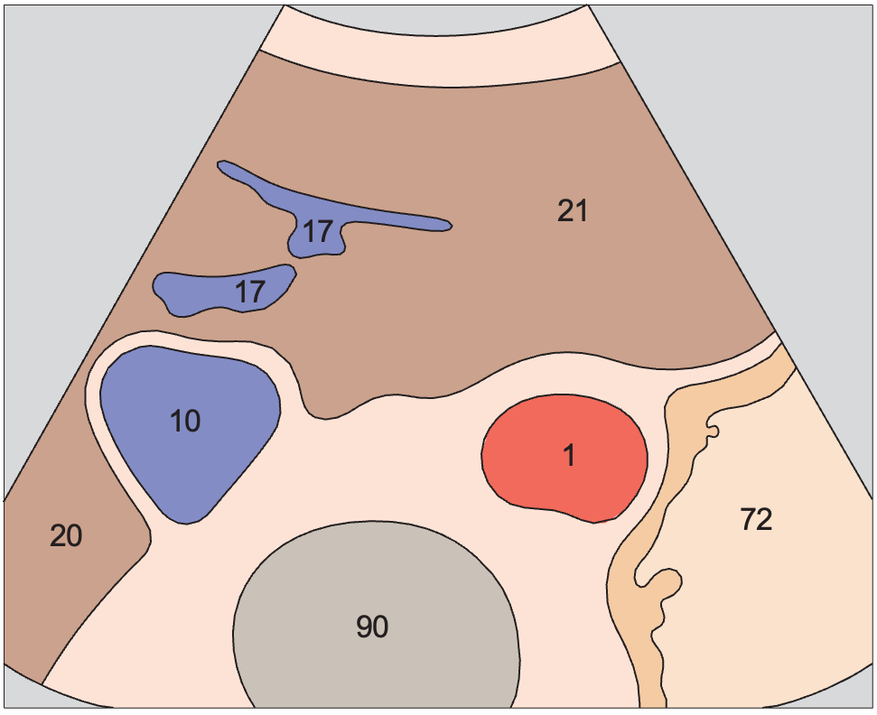 Body of stomach, aorta, liver
