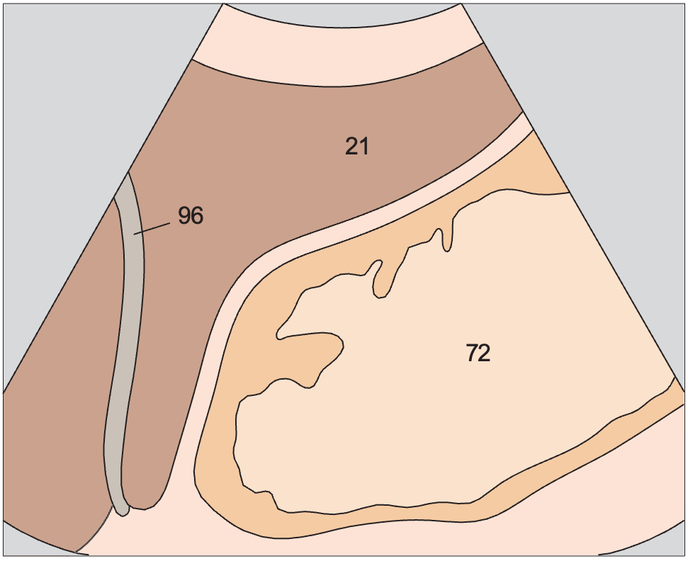 Body of stomach, liver