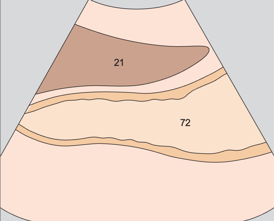 Body of stomach, liver