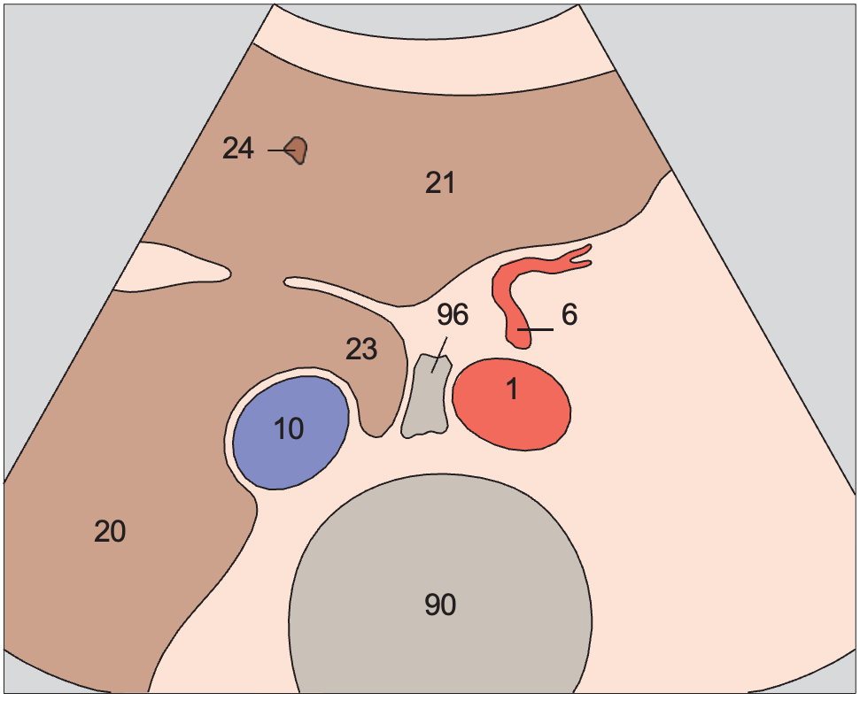 Left gastric artery