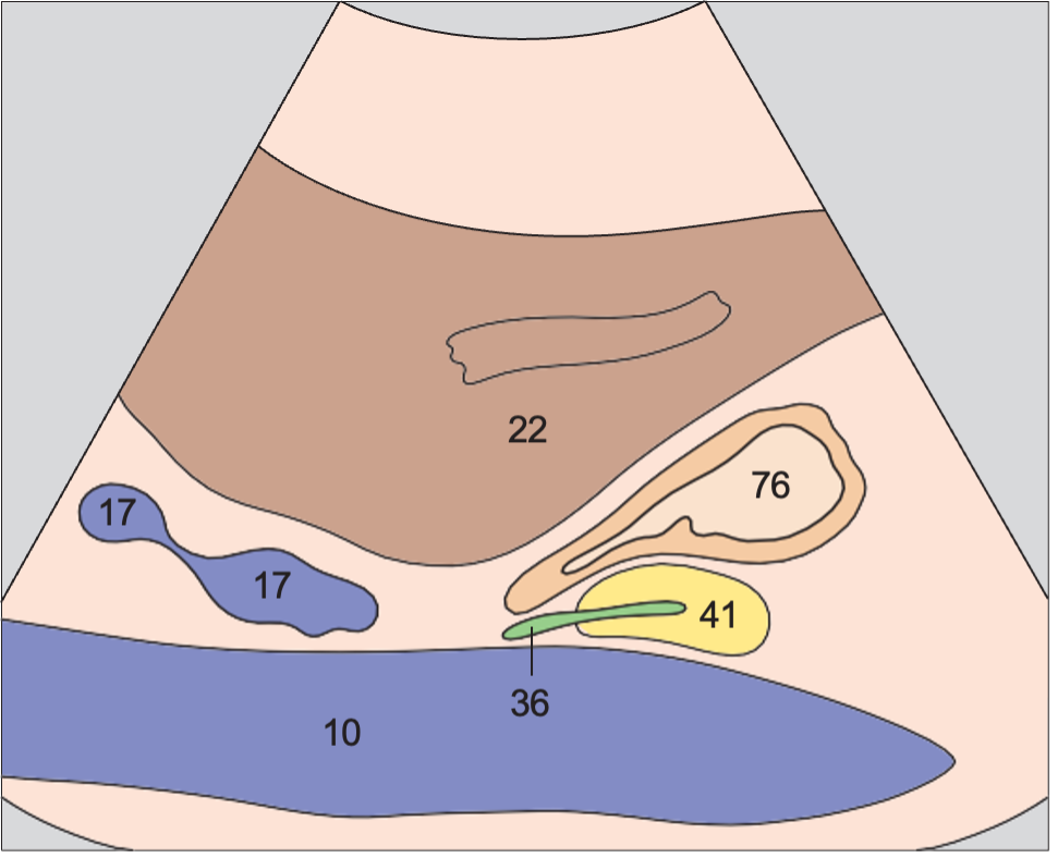 Duodenal bulb, liver, vena cava