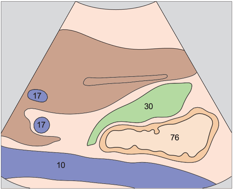 Duodenum, gallbladder, vena cava