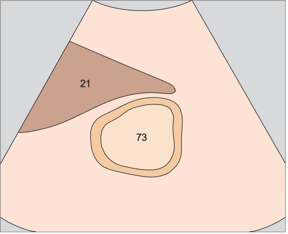 Layers of gastric wall