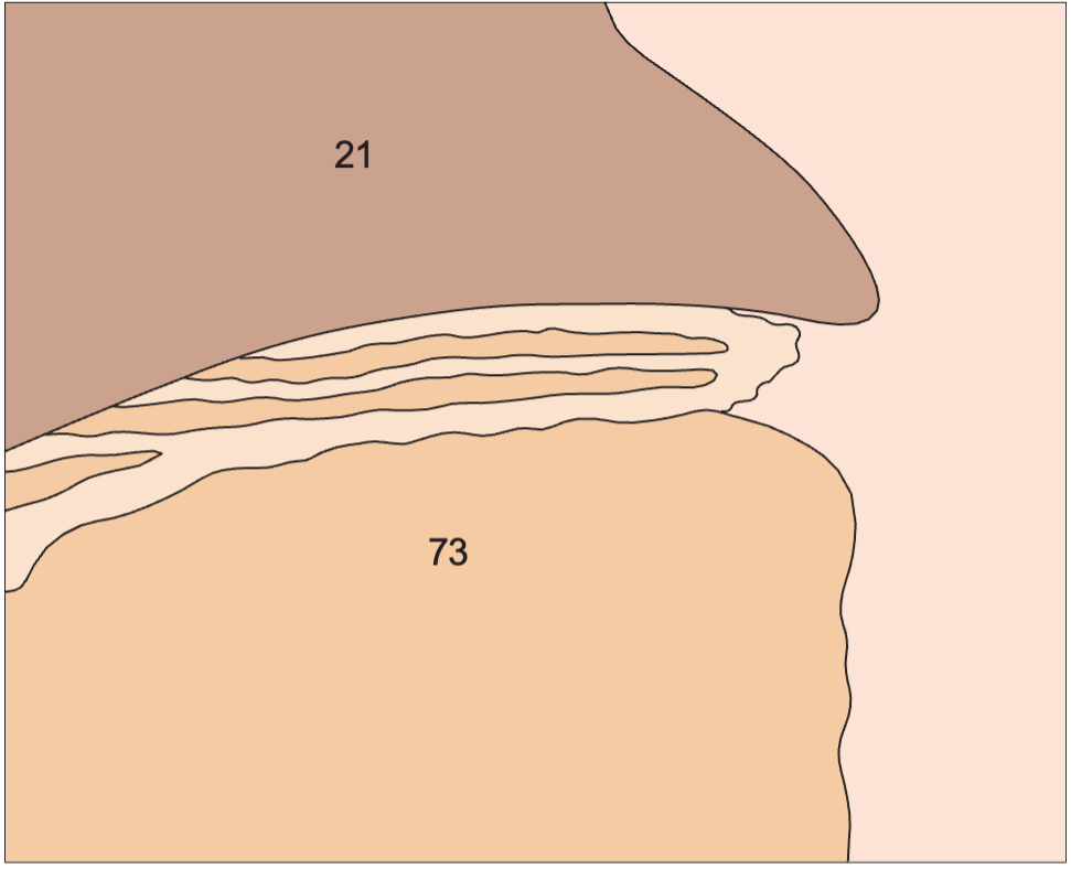 Layers of gastric wall