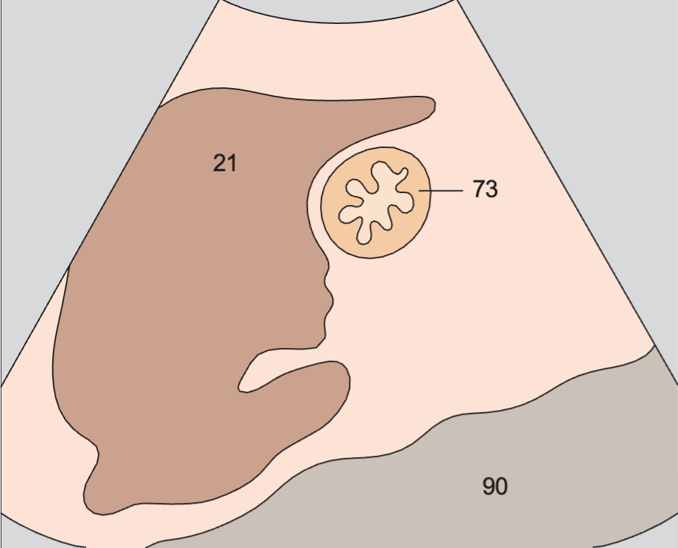 Gastric folds