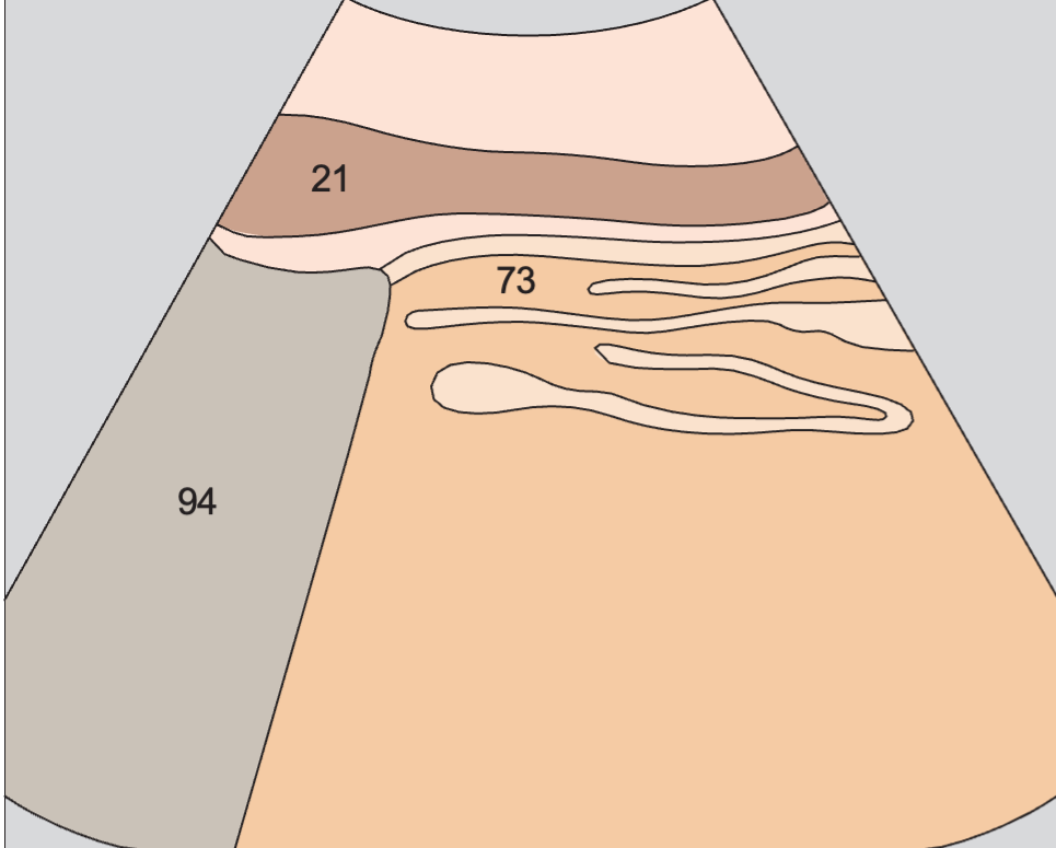 Gastric folds