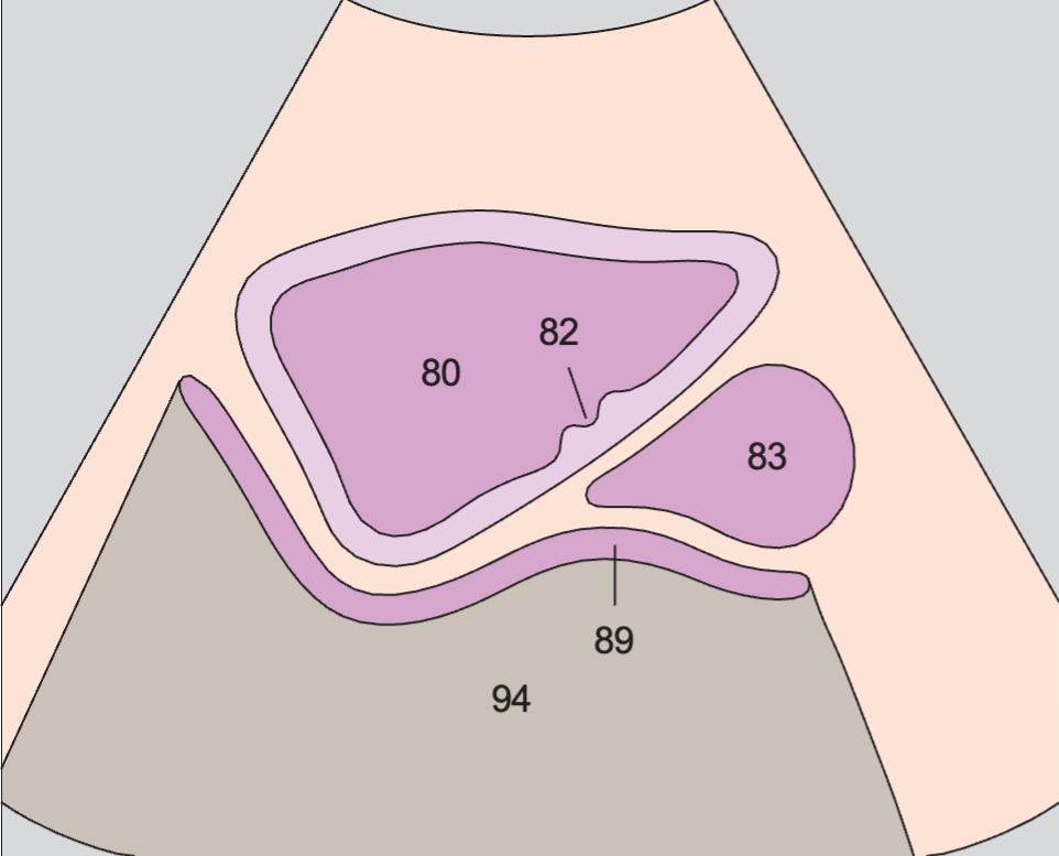 Bladder, prostate, rectum