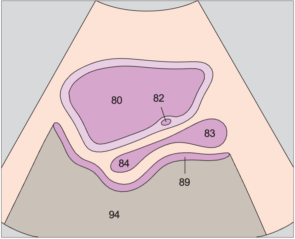 Bladder, ureteral orifice, prostate, rectum