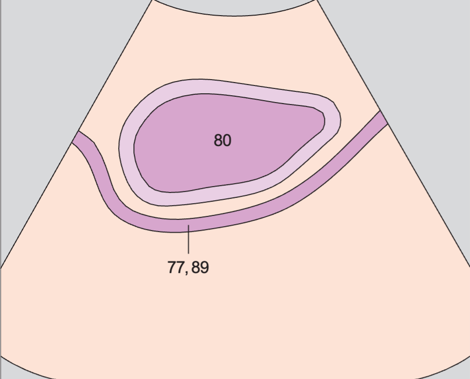 Bladder, rectum