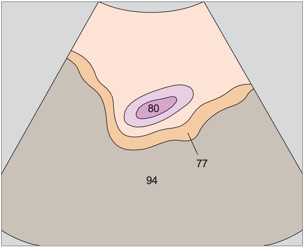 Bladder, bowel
