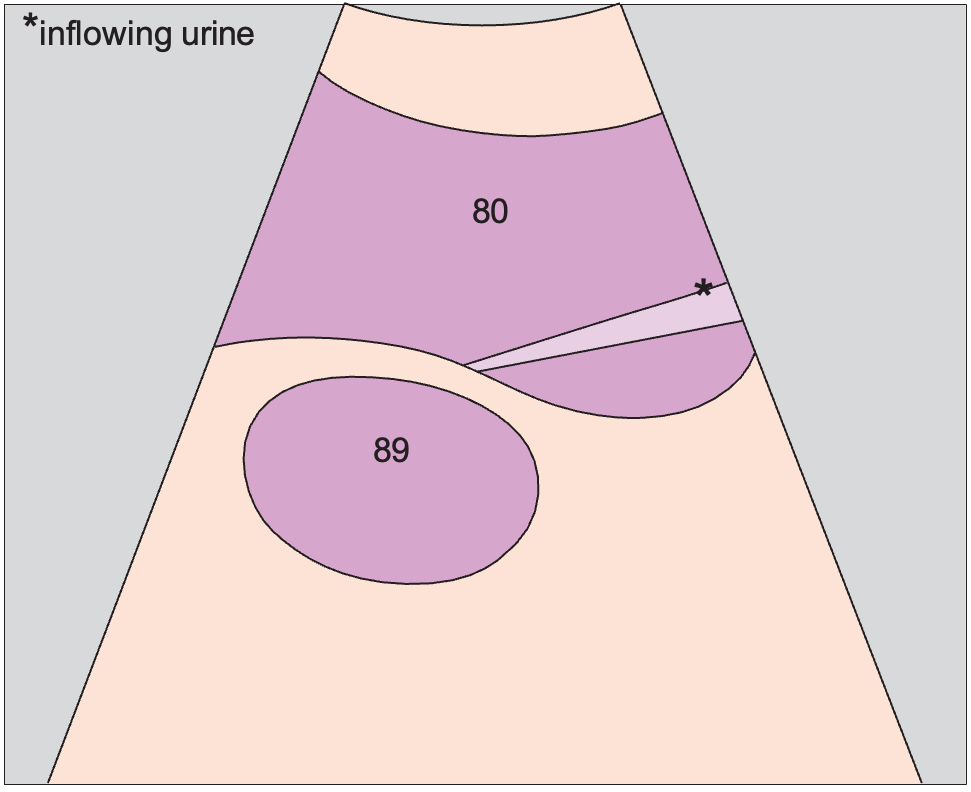Bladder, inflow of urine