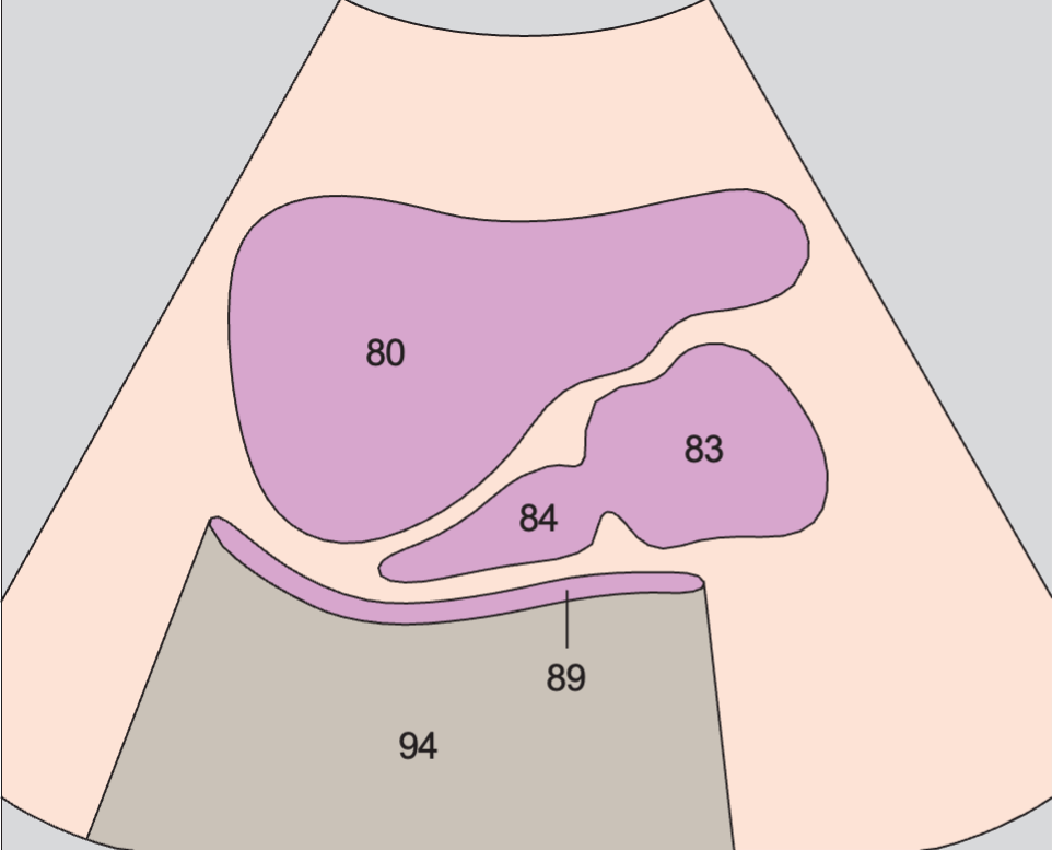 Prostate, rectum, bladder