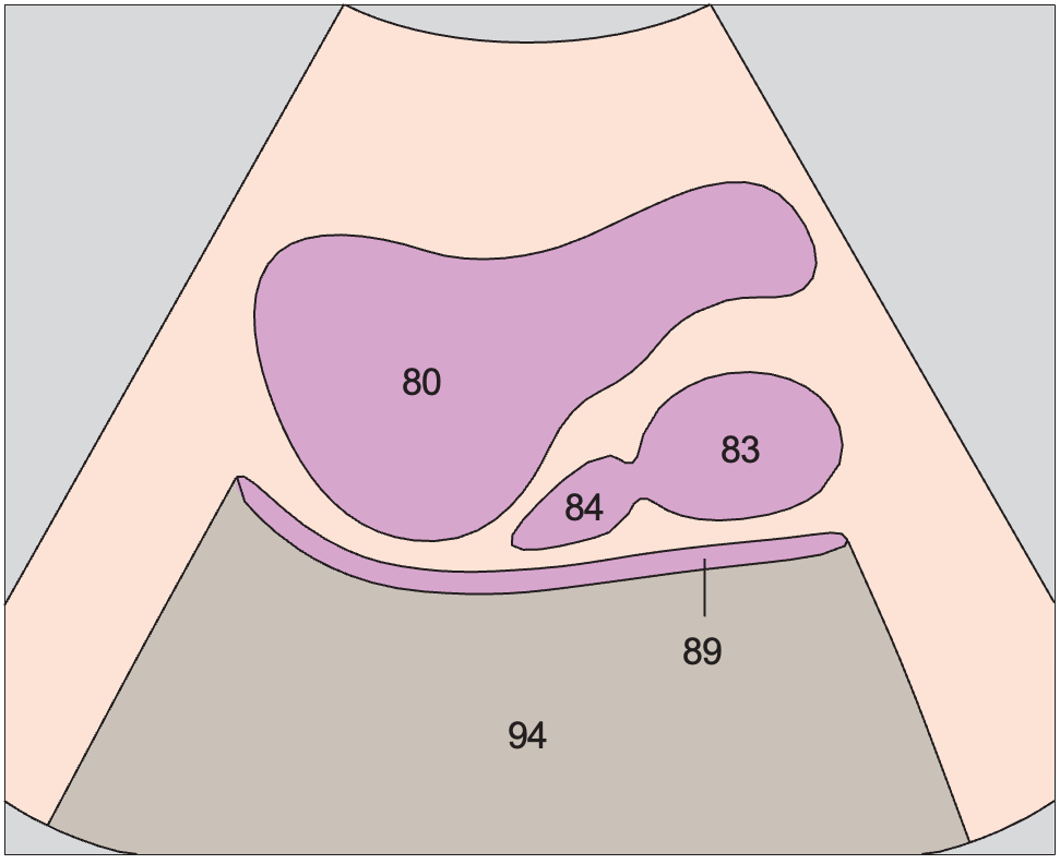 Prostate, rectum, bladder