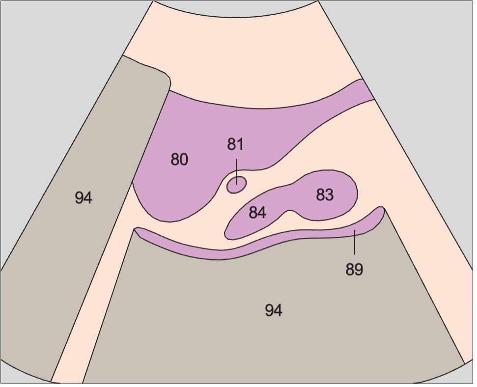Prostate, seminal vesicles