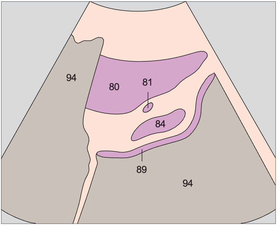 Prostate, seminal vesicles
