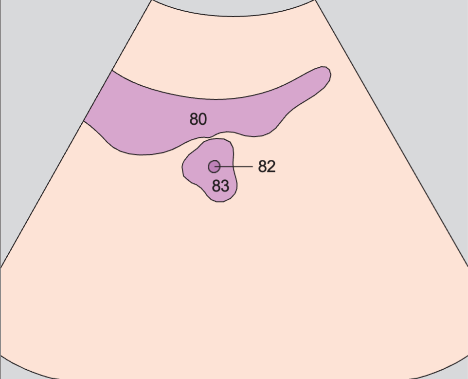 Prostate, urethra, bladder