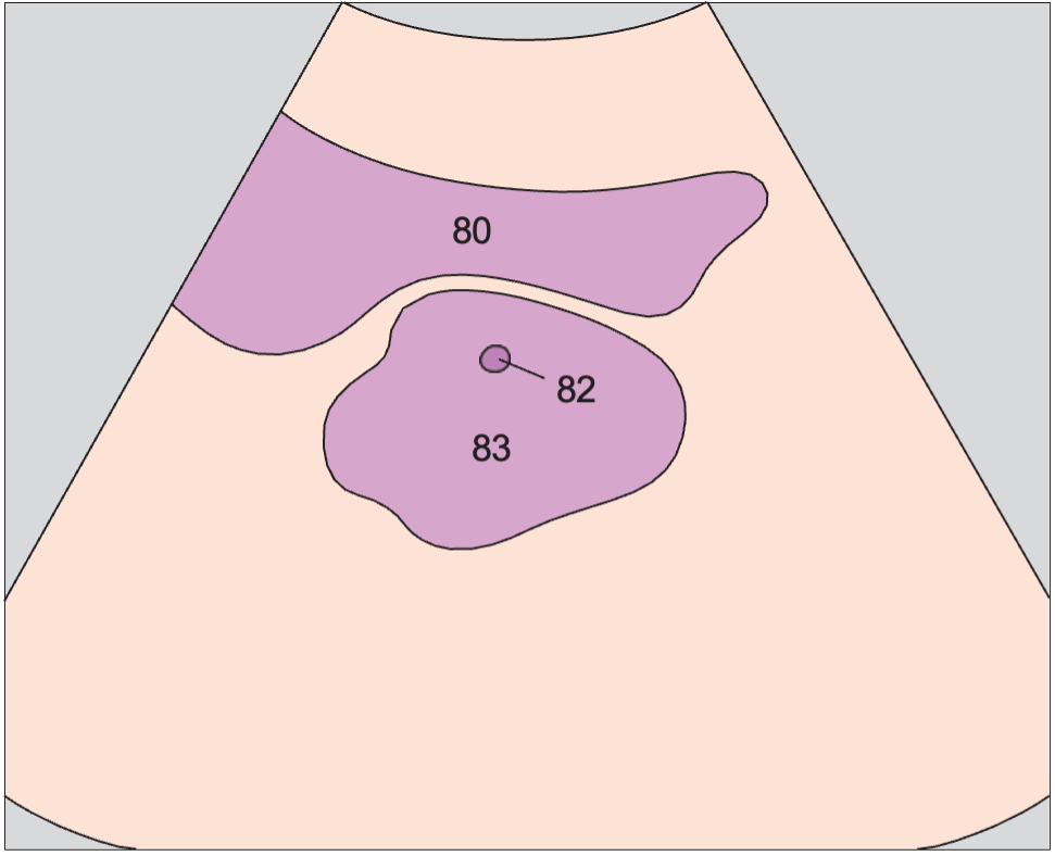 Prostate, urethra, bladder