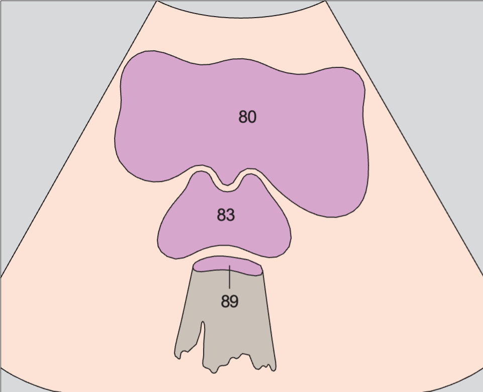 Prostate, bladder