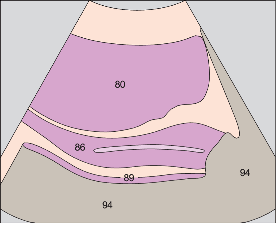 Vagina, bladder