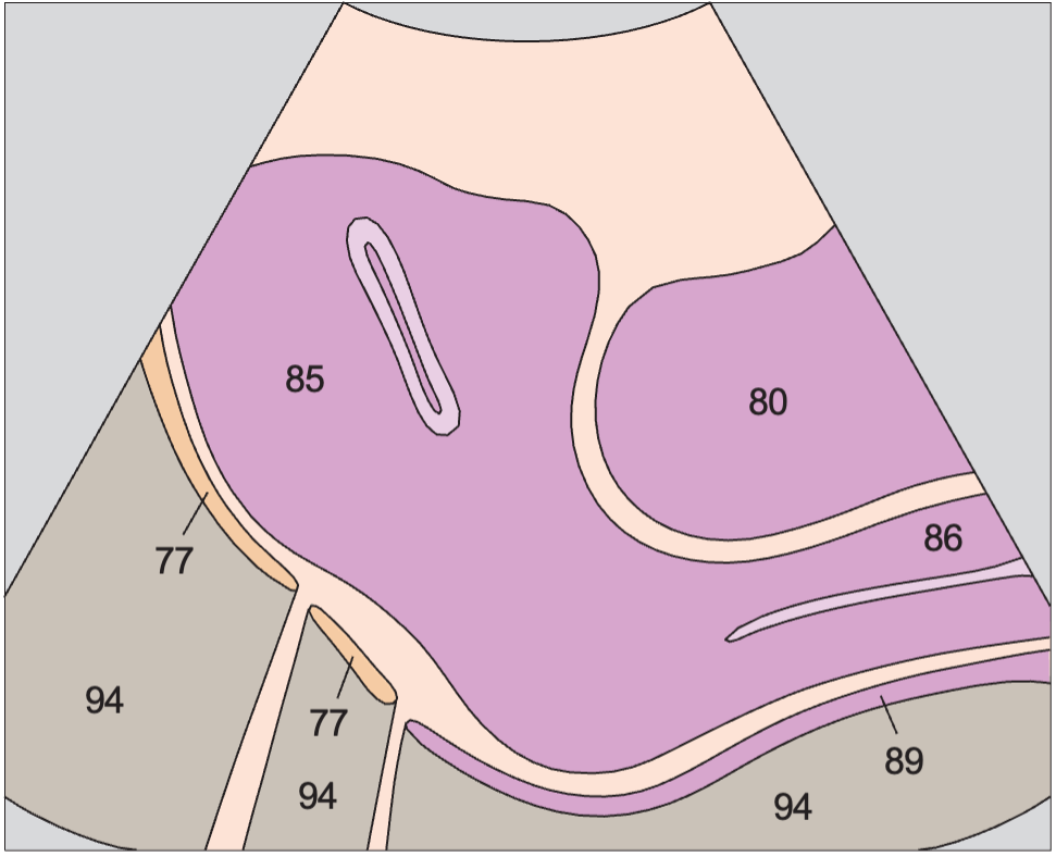Vagina, uterus, bladder