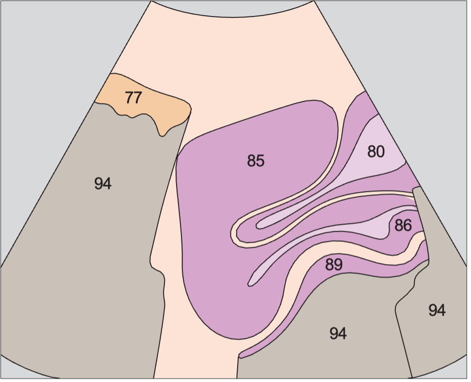 Vagina, uterus, bladder