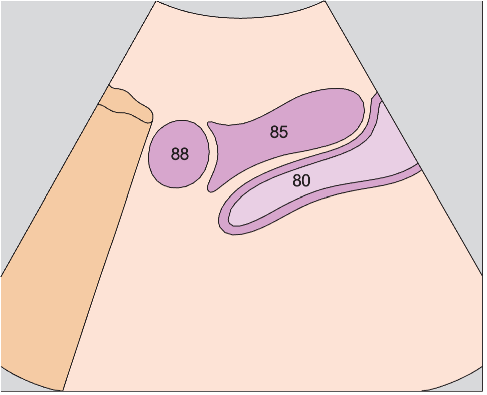 Uterus, ovary, bladder