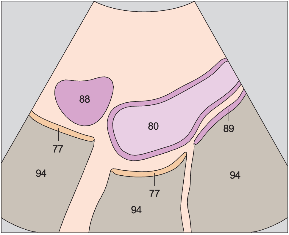 Bladder, ovary