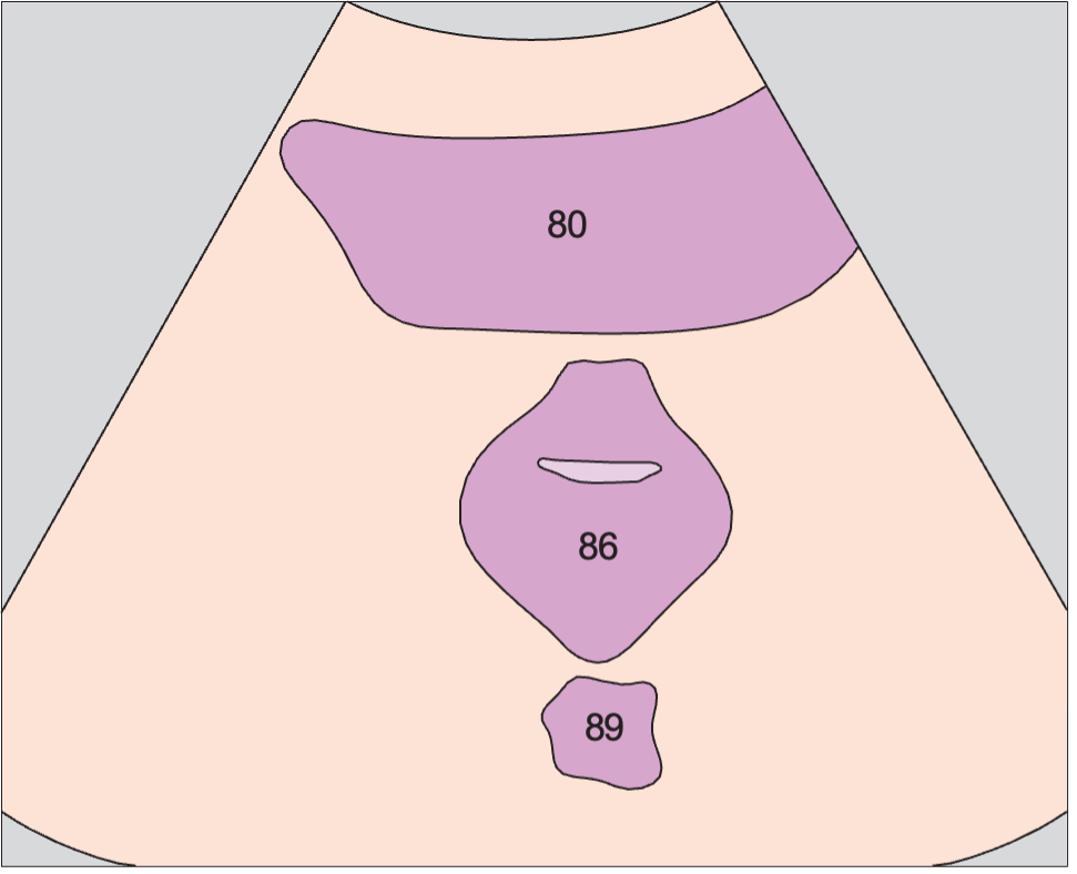 Vagina, bladder, rectum