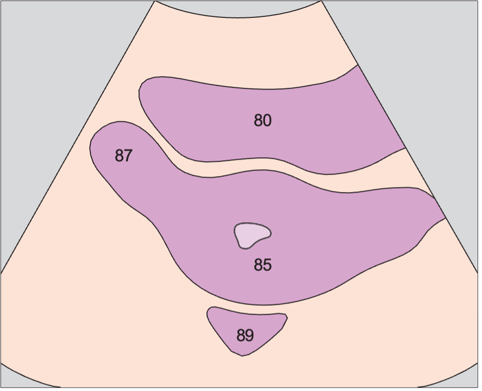Uterus, bladder, rectum, ovary
