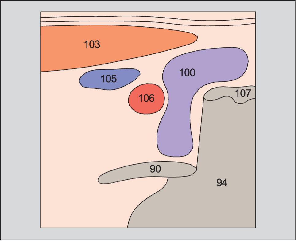 Right lobe of thyroid gland, sternocleidomastoid muscle, common carotid artery, internal jugular vein