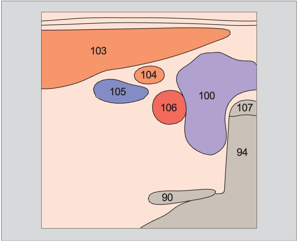 Left lobe of thyroid gland, sternocleidomastoid muscle, omohyoid muscle, common carotid artery, internal jugular vein