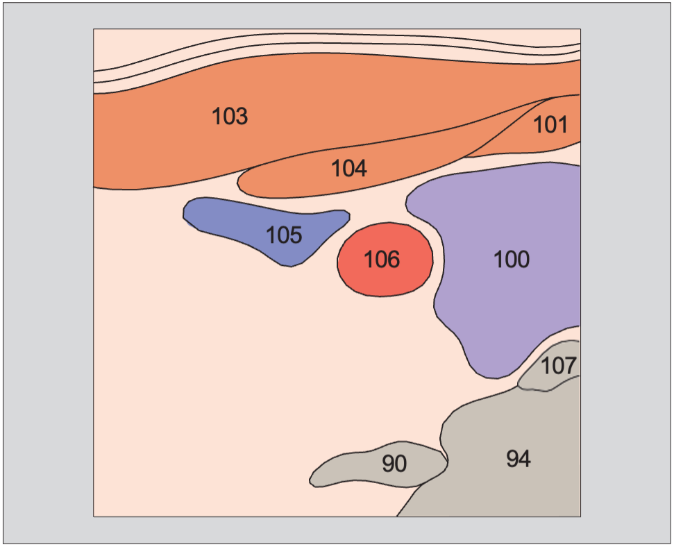 Right lobe of thyroid gland, sternocleidomastoid muscle, omohyoid muscle, sternohyoid muscle, common carotid artery, internal jugular vein