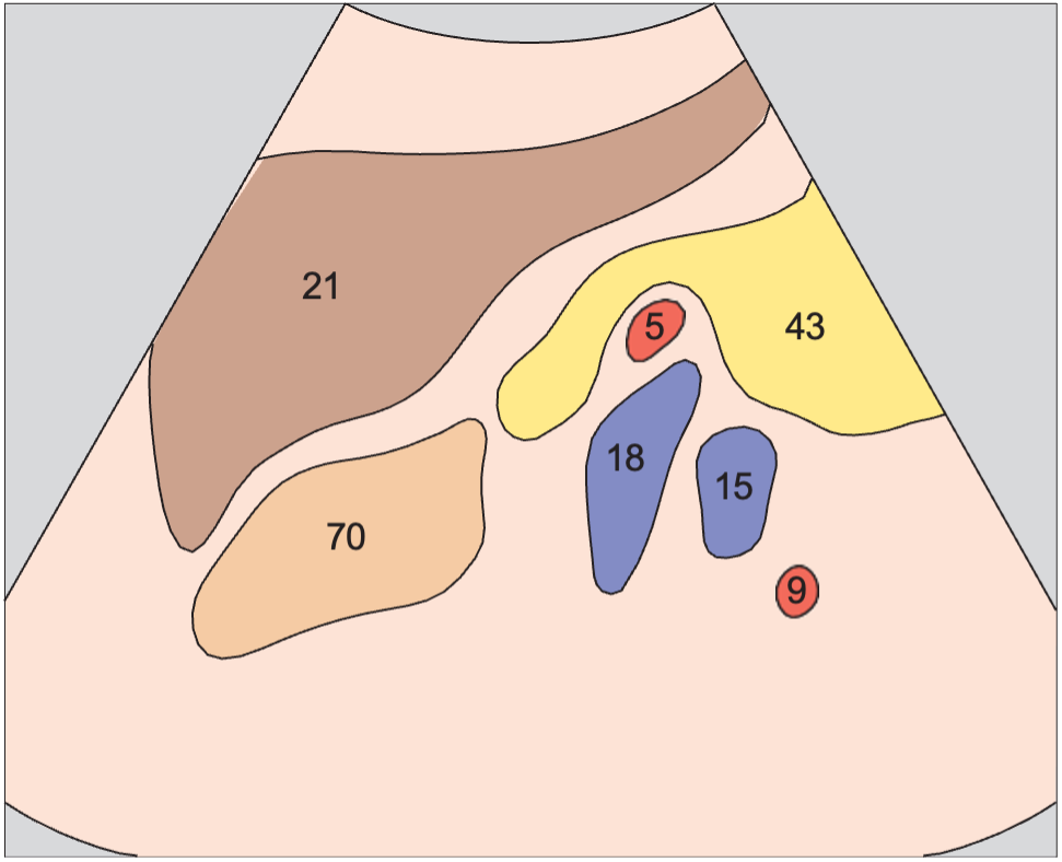 Splenic artery and vein, renal artery and vein