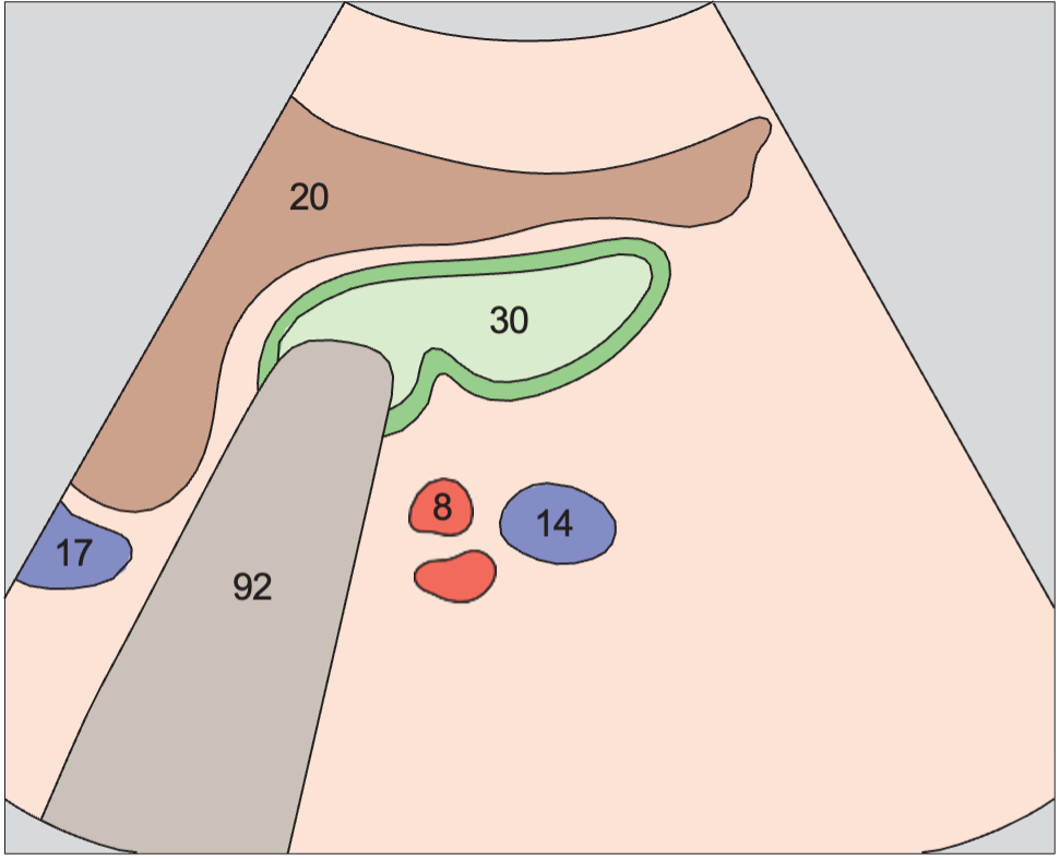 Right renal artery and right renal vein