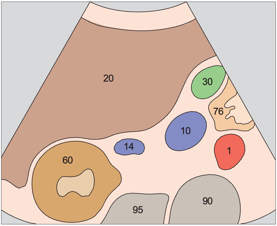 Renal vein