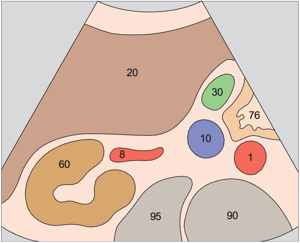 Renal artery