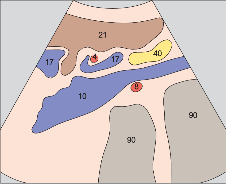 Vena cava