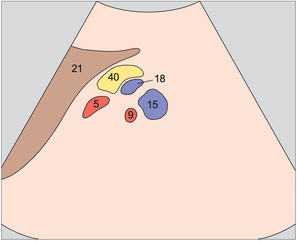 Left renal vessels, splenic artery and vein