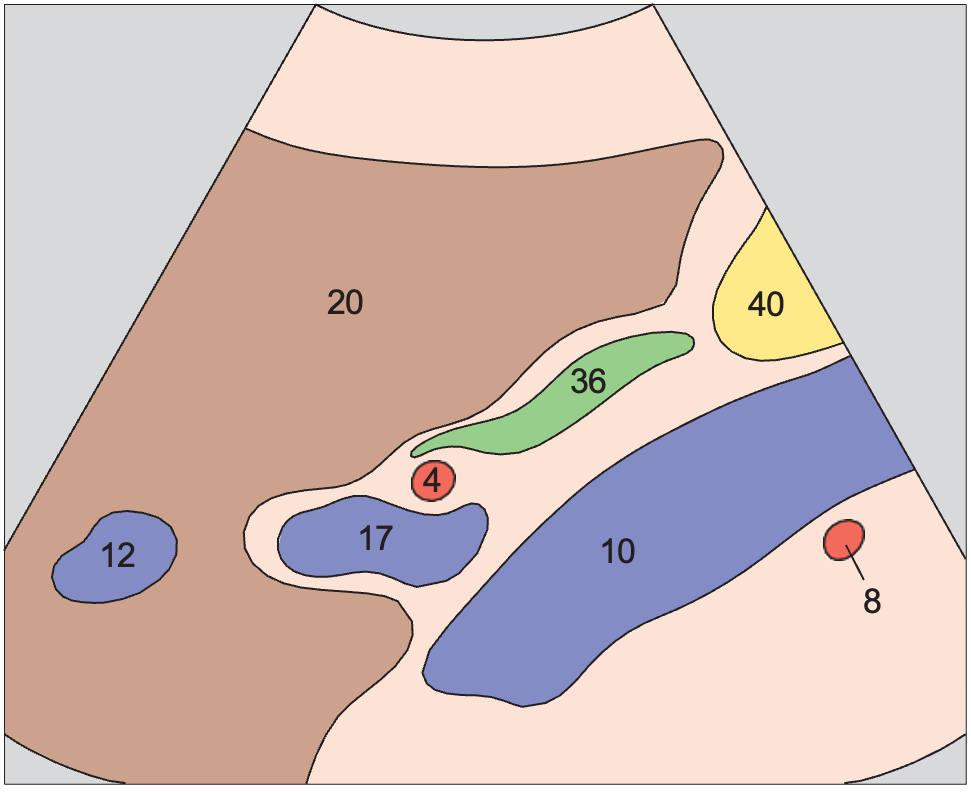 Portal vein, vena cava, right renal artery, and bile duct