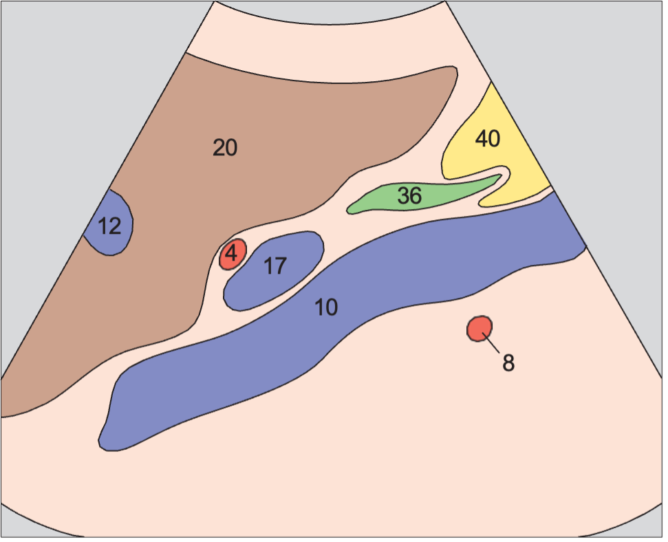 Portal vein, vena cava, and bile duct