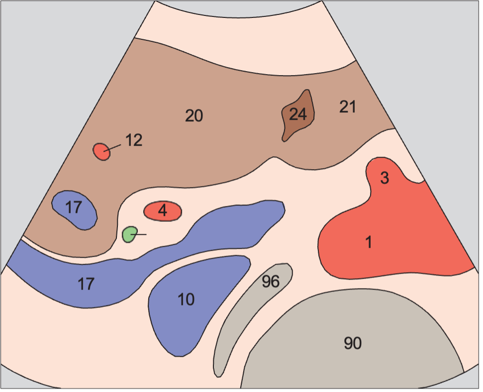 Hepatic artery, portal vein, vena cava