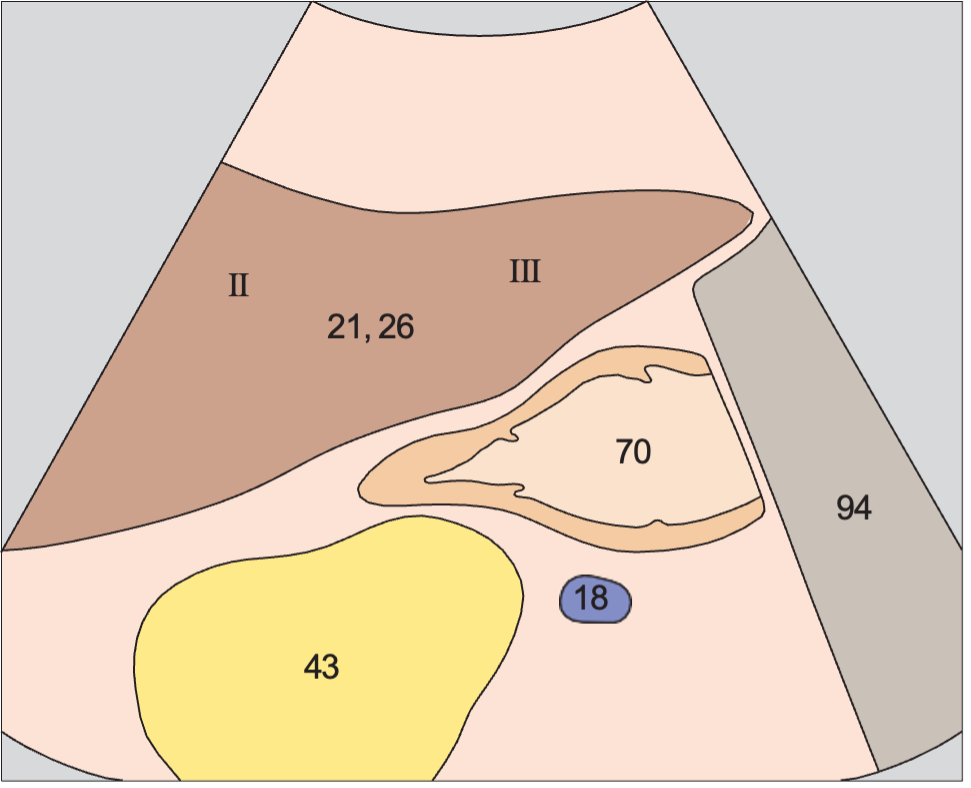 Left lobe of liver, lateral segment, subsegments II and III