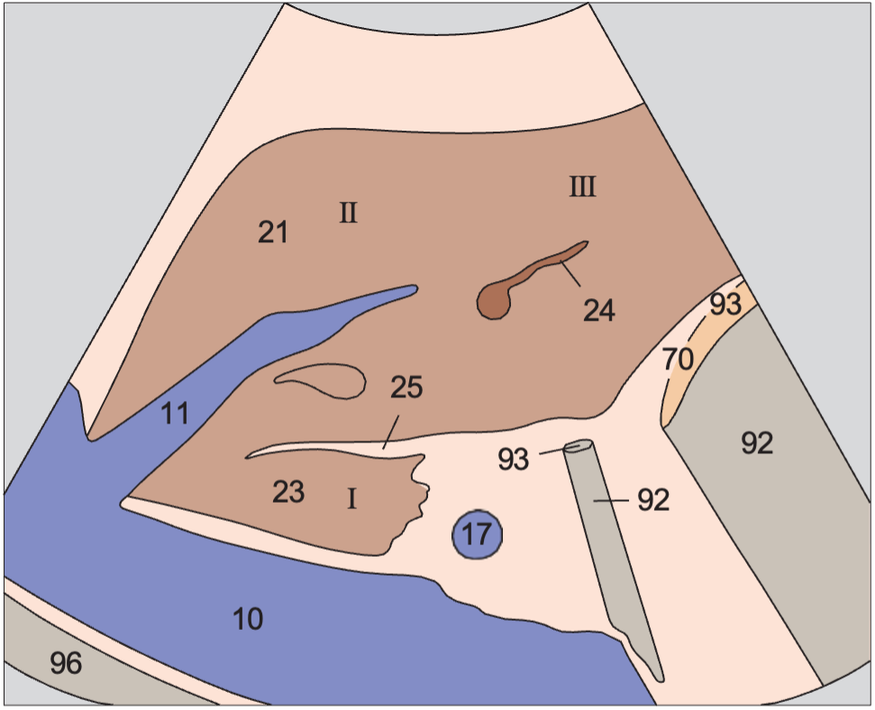 Left lobe of liver, ligamentum teres, boundary between lateral and medial segments, caudate lobe