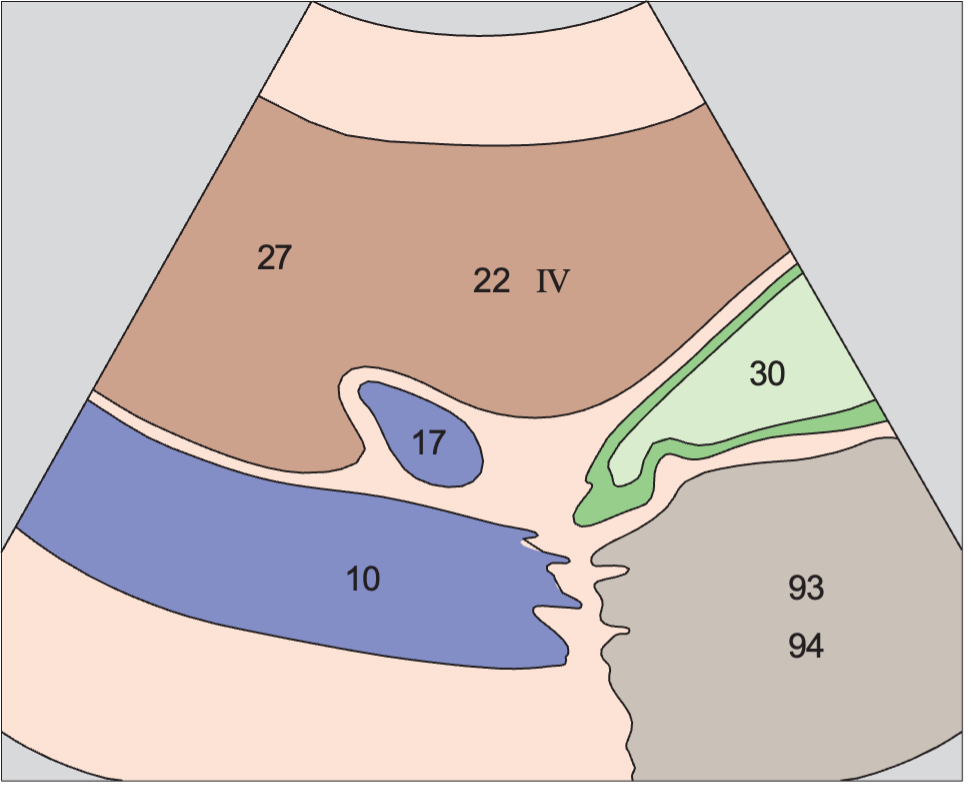 Gallbladder, portal vein, vena cava, boundary between medial and anterior segments